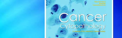 042518_art_cancer-article.jpg Cancer article cover