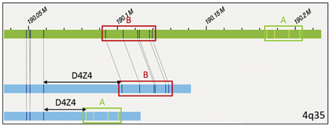Graphic of validation of optical genome mapping for the molecular diagnosis of facioscapulohumeral muscular dystrophy (FSHD). Graphic of validation of optical genome mapping for the molecular diagnosis of facioscapulohumeral muscular dystrophy (FSHD).