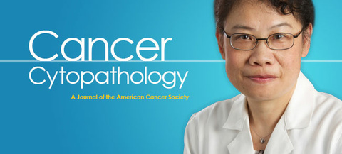 Deqin Ma Cancer Cytopathology article