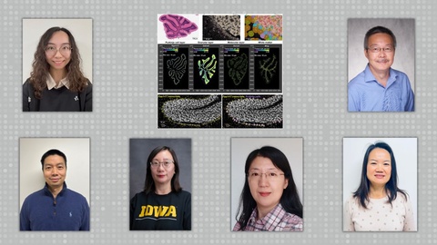 Luo Lab AUD Study 2025