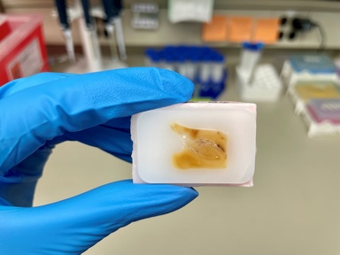 The Iowa Neuropathology Resource Laboratory is a central hub for resources related to neuropathology research and education and serves as the brain bank for the University of Iowa.