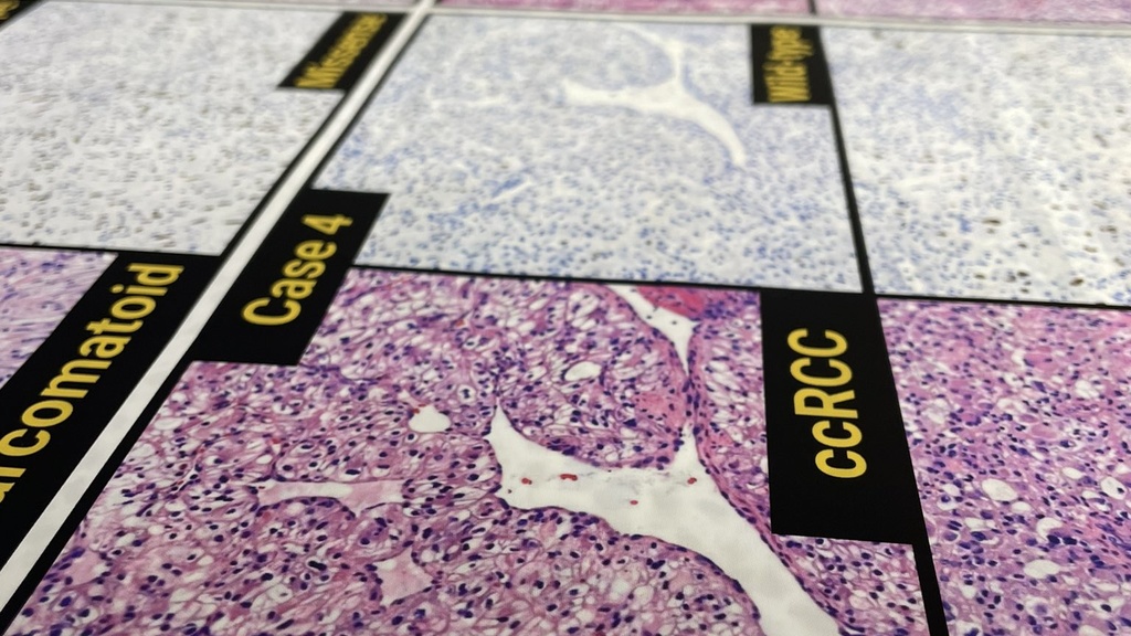 A close-up view of a research poster